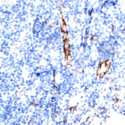 TSC1 (Hamartin) Monoclonal Antibody (5C8A12), Abbomax 100 &mu;g; Unconjugated:Antibodies,