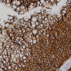 Ubiquitin Monoclonal Antibody (UBI-1), Abbomax 100 &mu;g; Unconjugated:Antibodies,