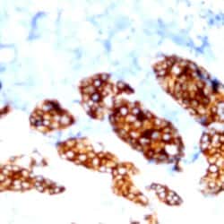 Phospho-Cytokeratin 8 (Ser431) Monoclonal Antibody (ABM271), Abbomax 100
