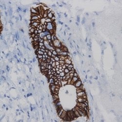 Cytokeratin 19 Monoclonal Antibody (ZY418), Abbomax 100 &mu;g; Unconjugated:Antibodies,