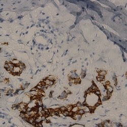Cytokeratin 17 Monoclonal Antibody (CK17), Abbomax 100 &mu;g; Unconjugated:Antibodies,