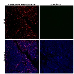 Ki-67 Monoclonal Antibody (SolA15), Alexa Fluor 660, eBioscience , Invitrogen:Antibodies:Primary