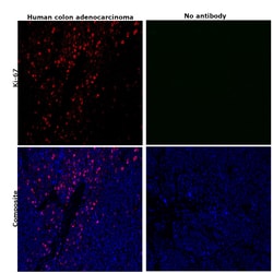 Ki-67 Monoclonal Antibody (SolA15), Alexa Fluor 660, eBioscience , Invitrogen:Antibodies:Primary