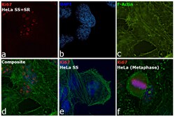 Ki-67 Monoclonal Antibody (SolA15), Alexa Fluor 660, eBioscience , Invitrogen:Antibodies:Primary