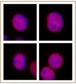 KLF5 Rabbit anti-Human, Mouse, Unconjugated, Polyclonal, Active Motif:Antibodies:Primary