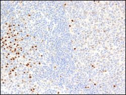 PIM2 Monoclonal Antibody (CHU61), Active Motif 10 &mu;g; Unconjugated:Antibodies,