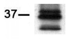 PIM2 Monoclonal Antibody (CHU61), Active Motif 10 &mu;g; Unconjugated:Antibodies,