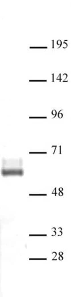 LXR-beta Polyclonal Antibody, Active Motif 100 &mu;L; Unconjugated:Antibodies,