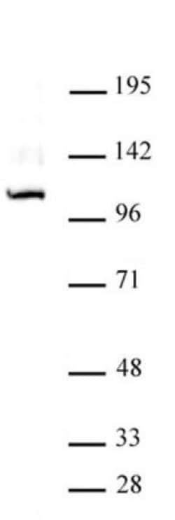 GLI1 Polyclonal Antibody, Active Motif:Antibodies:Primary Antibodies