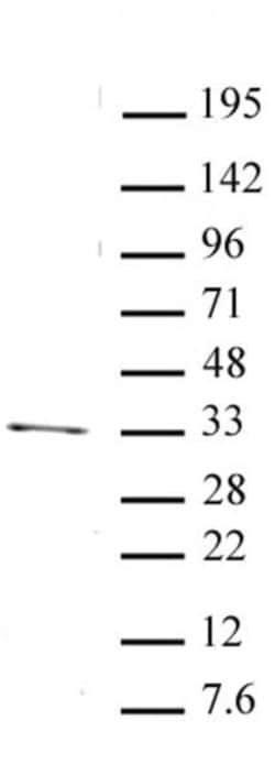 PITX2 Polyclonal Antibody, Active Motif:Antibodies:Primary Antibodies