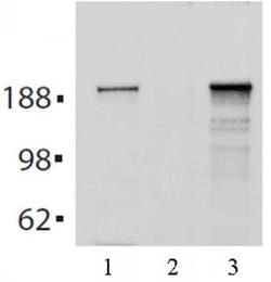 Tet2 Monoclonal Antibody (21F11), Active Motif:Antibodies:Primary Antibodies