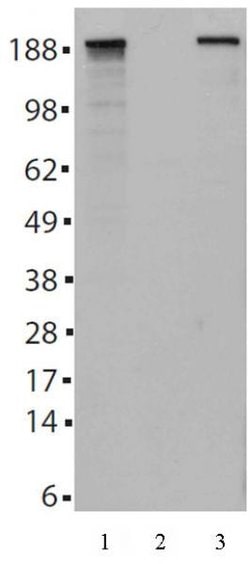 Tet2 Monoclonal Antibody (21F11), Active Motif:Antibodies:Primary Antibodies