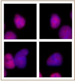 p300 Monoclonal Antibody (NM11), Active Motif 100 &mu;g; Unconjugated:Antibodies,