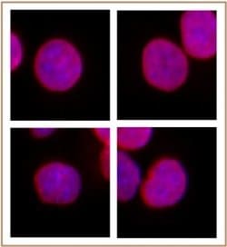 SMARCC1 / BAF155 Polyclonal Antibody, Active Motif 100 &mu;L; Unconjugated:Antibodies,