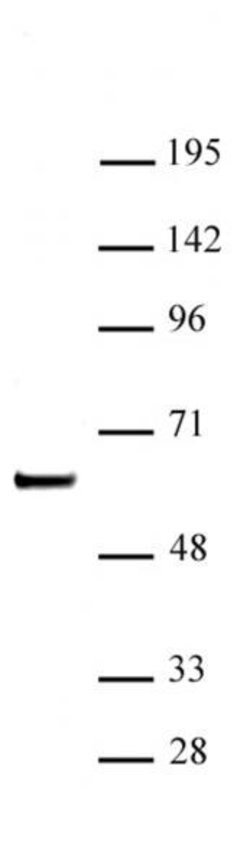 SETD7 / SET7 Polyclonal Antibody, Active Motif:Antibodies:Primary Antibodies