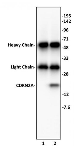Active Motif CDKN2A Polyclonal Antibody:Antibodies:Primary Antibodies