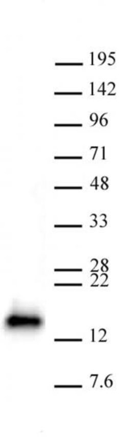Active Motif CDKN2A Polyclonal Antibody:Antibodies:Primary Antibodies