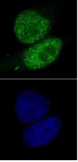SMARCA4 Monoclonal Antibody (5B7), Active Motif 10 &mu;g; Unconjugated:Antibodies,