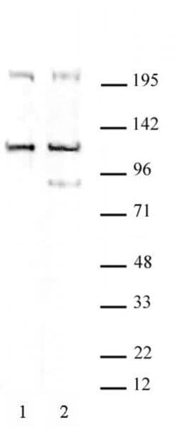 TRIM37 Polyclonal Antibody, Active Motif:Antibodies:Primary Antibodies