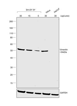 Invitrogen Goat anti-Mouse IgM (Heavy chain) Secondary Antibody, HRP 1