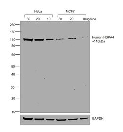 Invitrogen Goat anti-Human IgG (Gamma chain) Cross-Adsorbed Secondary Antibody,