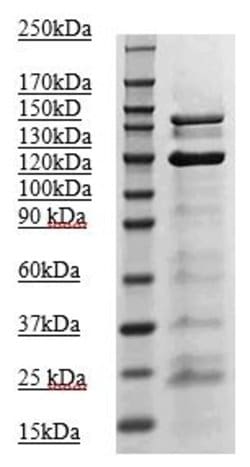 Phospho-JAK2 (Tyr1007, Tyr1008) Polyclonal Antibody, Biotin, Abbomax 100 &mu;g | Buy Online | Abbomax Inc | Fisher Scientific