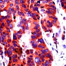 Notch 1 Polyclonal Antibody, Abbomax 100 &mu;g | Buy Online | Abbomax Inc | Fisher Scientific