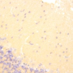 Tau Polyclonal Antibody, Abbomax 100 &mu;g | Buy Online | Abbomax Inc | Fisher Scientific