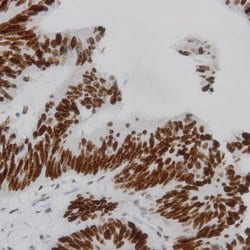 Phospho-IKK-b (Tyr199) Polyclonal Antibody, Abbomax 100 &mu;g; Unconjugated:Antibodies,