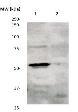 Phospho-TGFBR1 (Ser165) Polyclonal Antibody, Abbomax 100 &mu;g | Buy Online | Abbomax Inc | Fisher Scientific