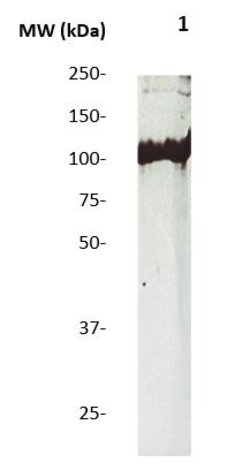 Phospho-AXL/UFO (Tyr770, Tyr812, Tyr857) Polyclonal Antibody, Abbomax 100