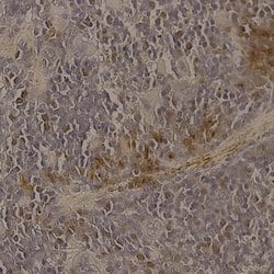 ADM2 Polyclonal Antibody, Abbomax 100 &mu;g; Unconjugated:Antibodies, Polyclonal