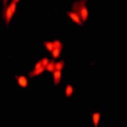 Cit-Histone H3 (Arg2, Arg8, Arg17) Polyclonal Antibody, Abbomax 100 &mu;g;