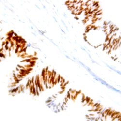 Phospho-Nucleophosmin (NPM) (Ser70) Polyclonal Antibody, Abbomax 100 &mu;g;