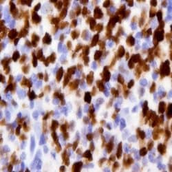TWIST1/2 Polyclonal Antibody, Abbomax 100 &mu;g; Unconjugated:Antibodies,