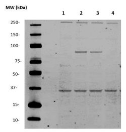 TWIST1/2 Polyclonal Antibody, Abbomax 100 &mu;g; Unconjugated:Antibodies,