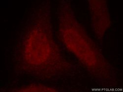 DDB1 Mouse anti-Human, Mouse, Rat, Clone: 4F6C6, Proteintech 20 &mu;L;