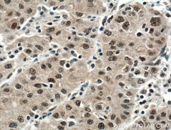 DDB1 Mouse anti-Human, Mouse, Rat, Clone: 4F6C6, Proteintech 20 &mu;L;