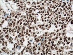 DDB1 Mouse anti-Human, Mouse, Rat, Clone: 4F6C6, Proteintech 20 &mu;L;