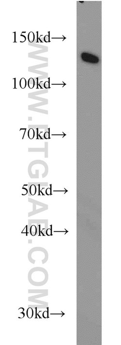 DDB1 Mouse anti-Human, Mouse, Rat, Clone: 4F6C6, Proteintech 20 &mu;L;
