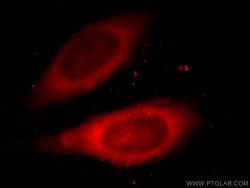 DDB1 Mouse anti-Human, Mouse, Rat, Clone: 4F6C6, Proteintech 20 &mu;L;