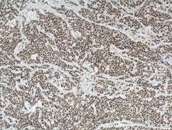 DDB1 Mouse anti-Human, Mouse, Rat, Clone: 4F6C6, Proteintech 20 &mu;L;
