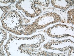 DDB1 Mouse anti-Human, Mouse, Rat, Clone: 4F6C6, Proteintech 20 &mu;L;
