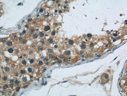 DDB1 Mouse anti-Human, Mouse, Rat, Clone: 4F6C6, Proteintech 20 &mu;L;