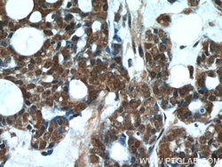 DDB1 Mouse anti-Human, Mouse, Rat, Clone: 4F6C6, Proteintech 20 &mu;L;