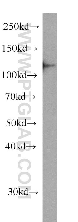 DDB1 Mouse anti-Human, Mouse, Rat, Clone: 4F6C6, Proteintech 20 &mu;L;