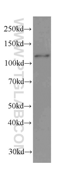 DDB1 Mouse anti-Human, Mouse, Rat, Clone: 4F6C6, Proteintech 20 &mu;L;