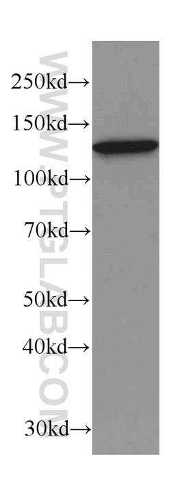 DDB1 Mouse anti-Human, Mouse, Rat, Clone: 4F6C6, Proteintech 20 &mu;L;