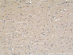 Thumbnail_GEFT Mouse anti-Human, Mouse, Rat, Clone: 5A11F8, Proteintech 150 &mu;L;