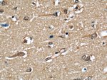 Thumbnail_GEFT Mouse anti-Human, Mouse, Rat, Clone: 5A11F8, Proteintech 150 &mu;L;